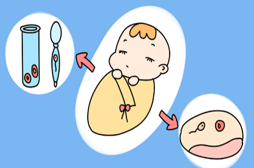 试管婴儿穿刺取精成功率，二代试管是否一定要穿刺取精？